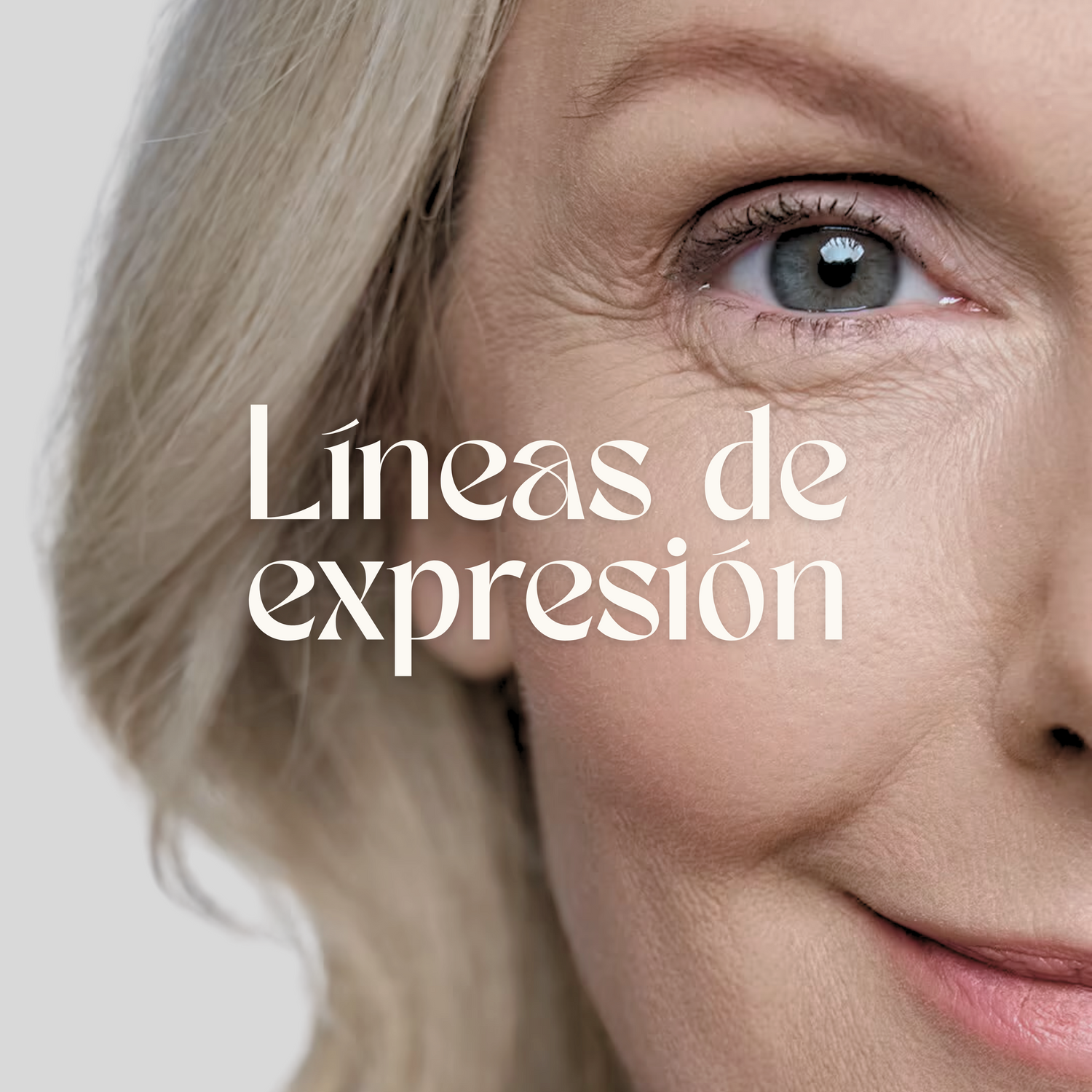 Líneas de expresión