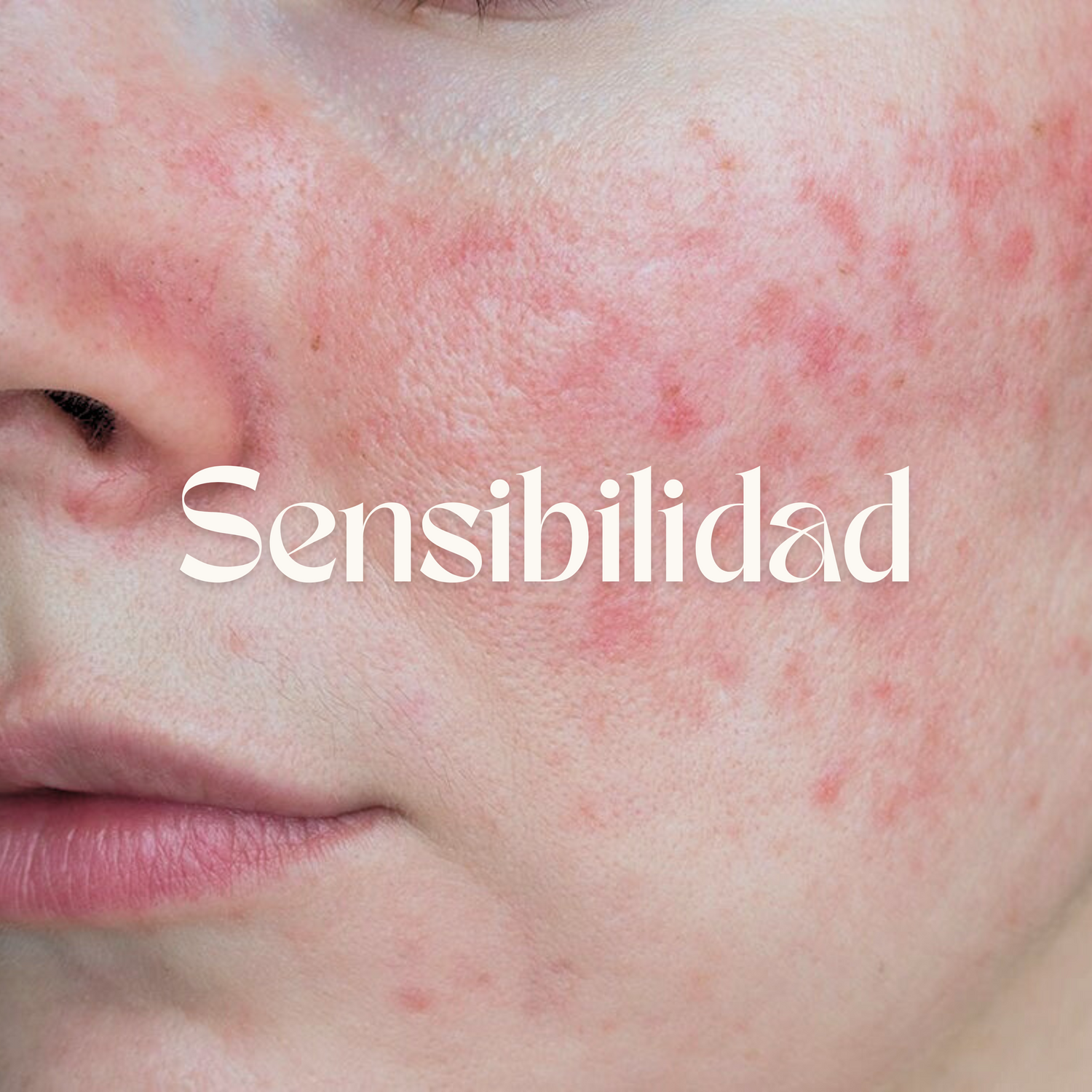 Sensibilidad